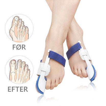 Fødder med hvide og blå hallux valgus-støtteskinner samt før- og efterillustrationer