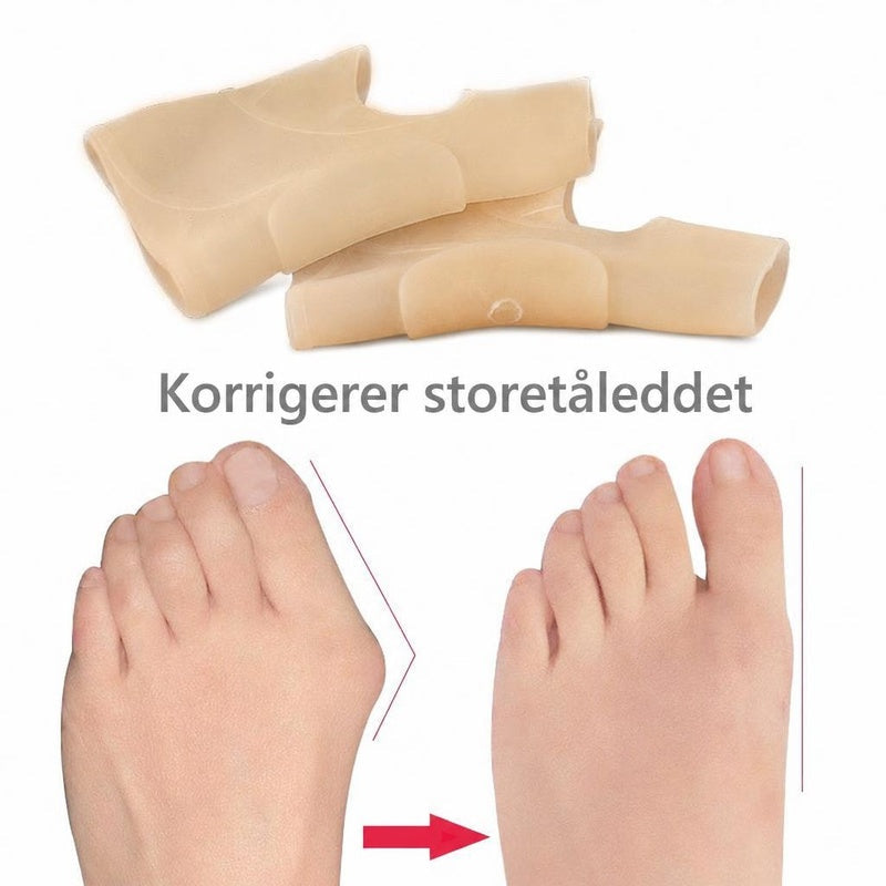 Beige silikone hallux valgus-støtter over før- og eftervisning af fødder