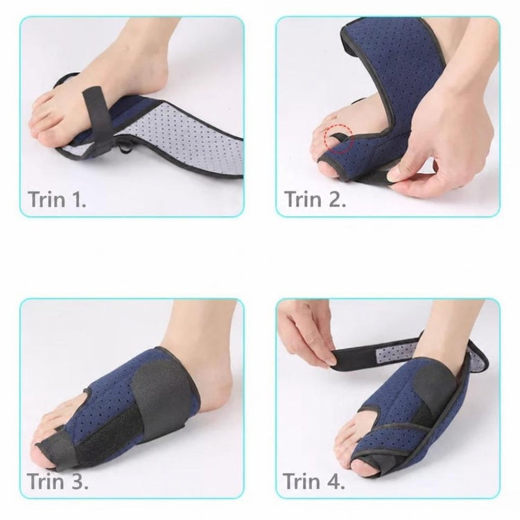 Blå hallux valgus støtteskinne i tekstil vist i fire påføringstrin