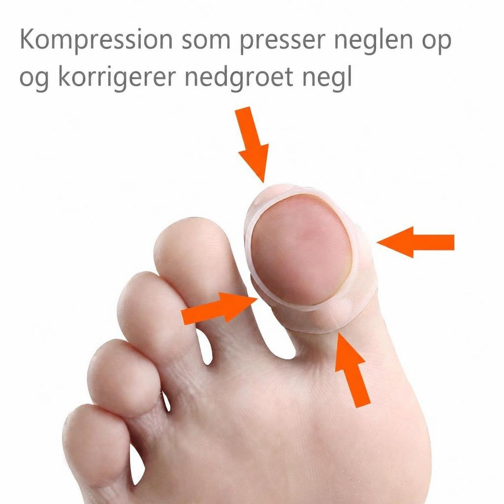 Storetå med transparent silikonebeskytter omkring neglen og orange pile