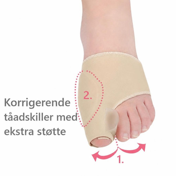 Fod med beige korrigerende tåspreder og støtte til storetåen