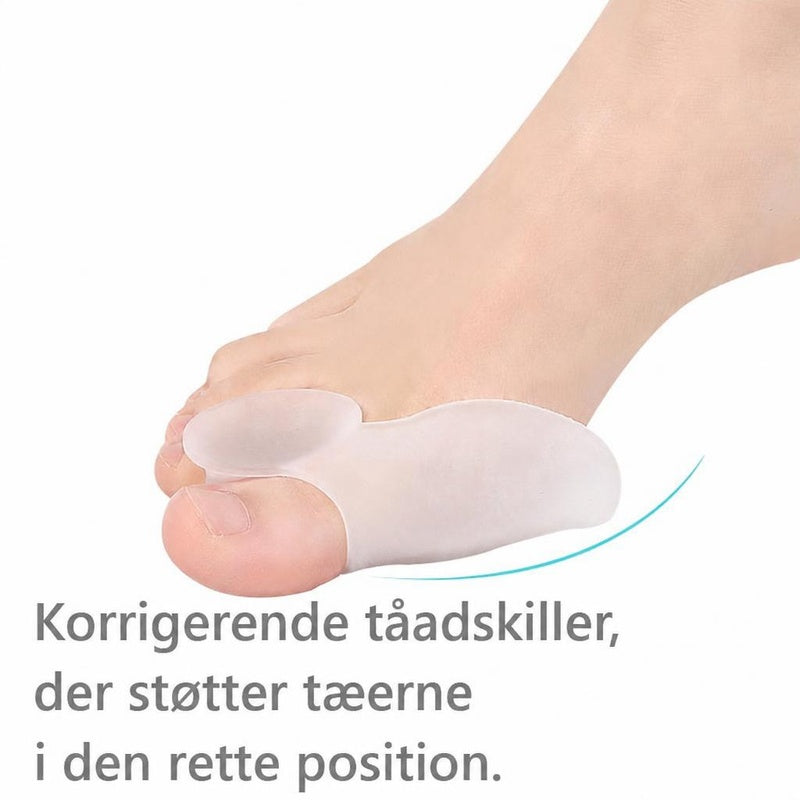 Fod med hvid tåspreder mellem storetå og de øvrige tæer