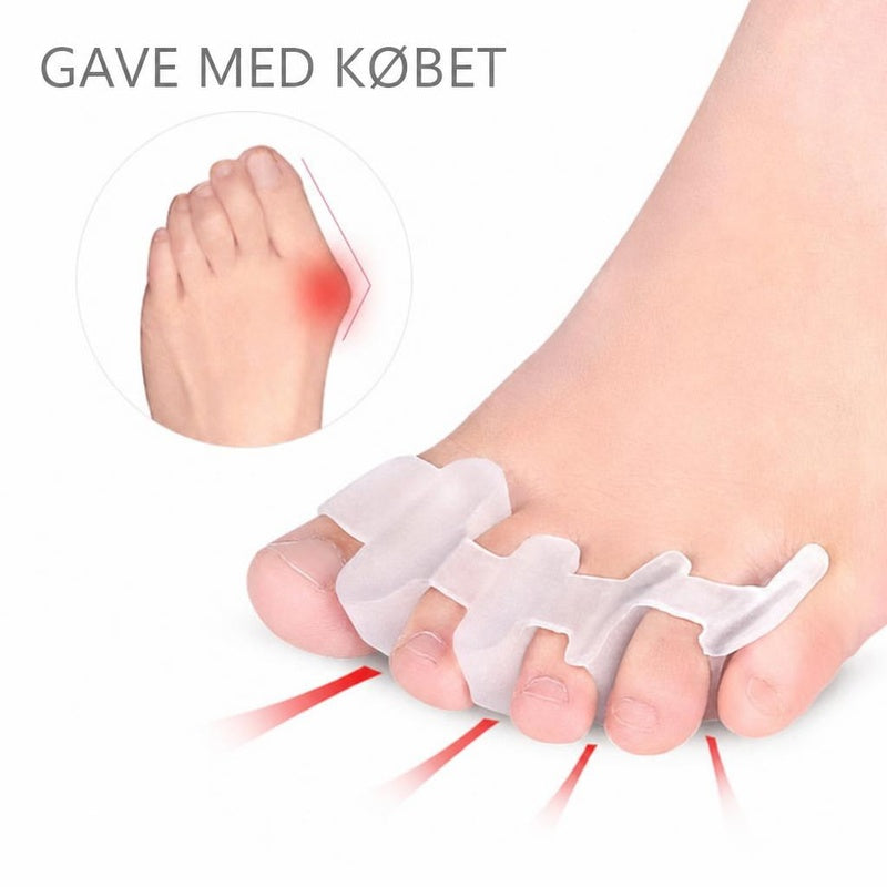 Fod med gennemsigtig tåspreder og indsat illustration af hallux valgus