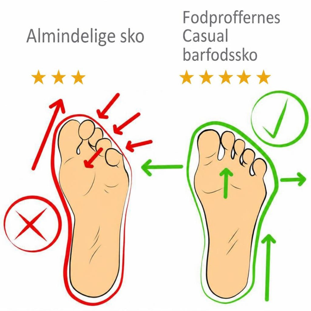 Infografik med fodformer, der sammenligner almindelige sko og Casual barfodssko