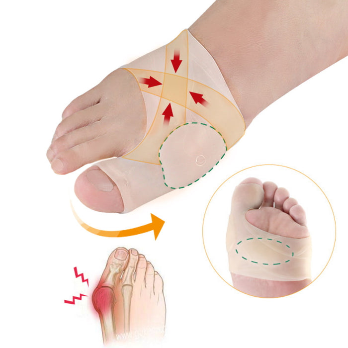 Silikonestøtte til hallux valgus på fod med pile og indsat undersidevisning