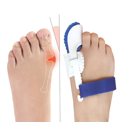 Fod med hallux valgus-illustration og fod med hvid-blå tåskinne